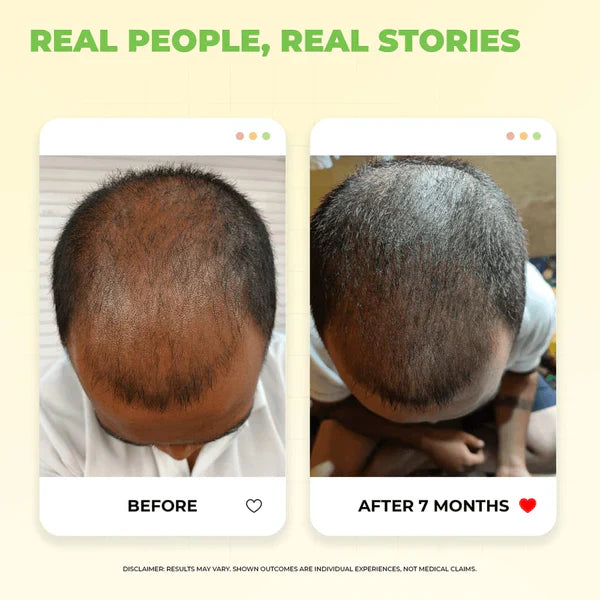 Ronaq e Zulf Premium Hair Oil | Natural Hair Growth & Hair Fall Control