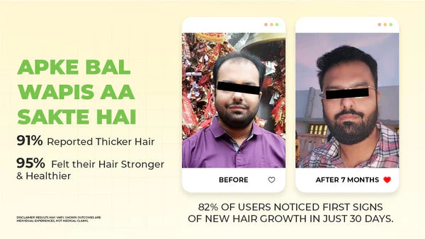 Ronaq e Zulf Premium Hair Oil | Natural Hair Growth & Hair Fall Control
